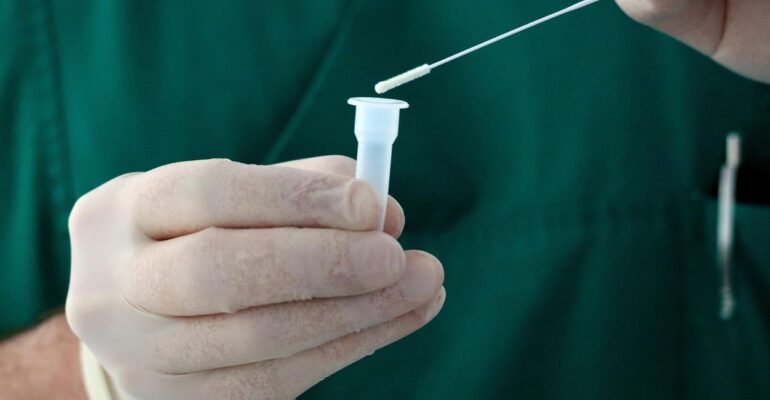 saliva-test
