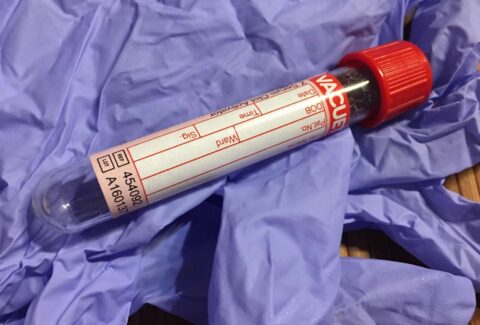 The Dangers Of Blood Testing For Reproductive Hormones