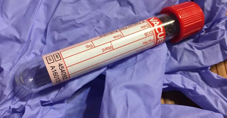 The Dangers Of Blood Testing For Reproductive Hormones